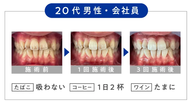 \ 30代 男性・会社員 /【 たばこ 】吸わない 【 コーヒー 】1日2杯 【 ワイン 】たまに