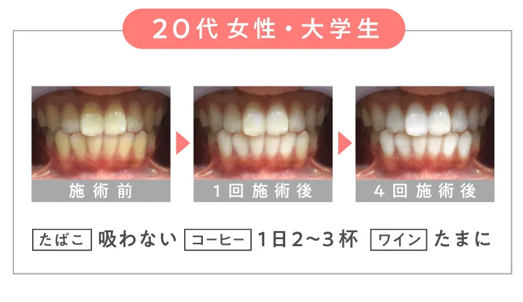 \ 20代 女性・大学生 /【 たばこ 】吸わない 【 コーヒー 】1日2~3杯 【 ワイン 】たまに