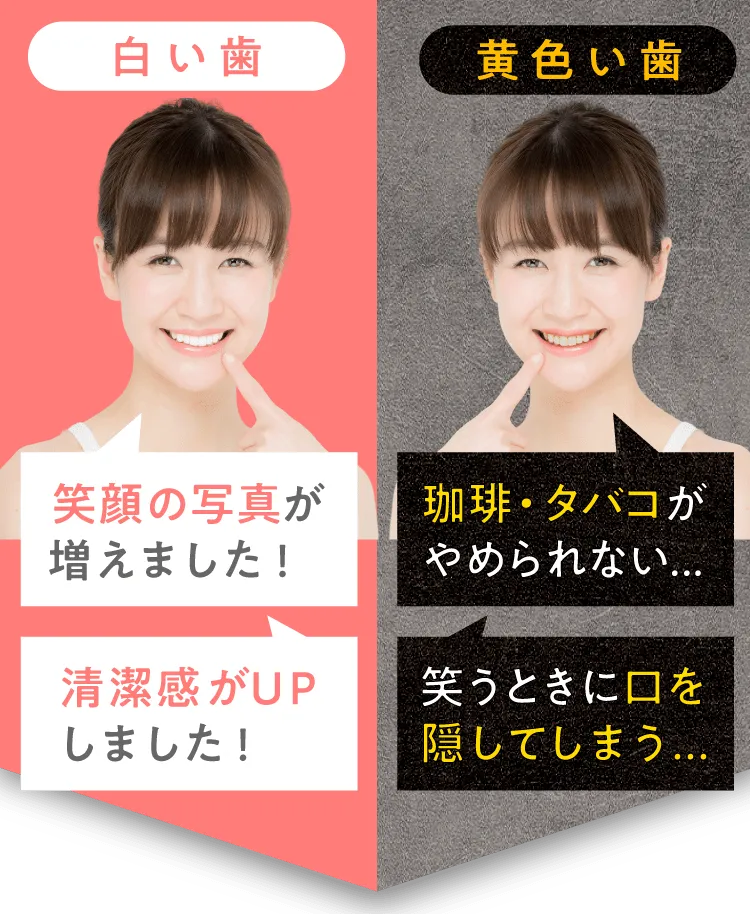 白い歯?黄色い歯?