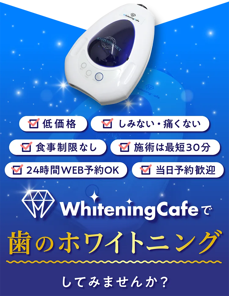 ホワイトニングカフェでホワイトニングしてみませんか?